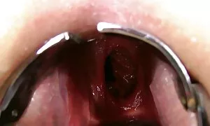 डबल गुदा मुठभेड़, प् ...